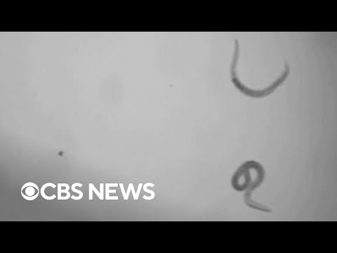 Ancient worms revived after 46,000 years in the Siberian permafrost