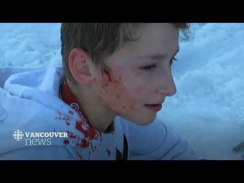 Teen has brain punctured by skier during conflict