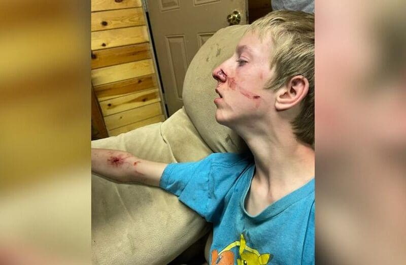 Arizona black bear attack victim