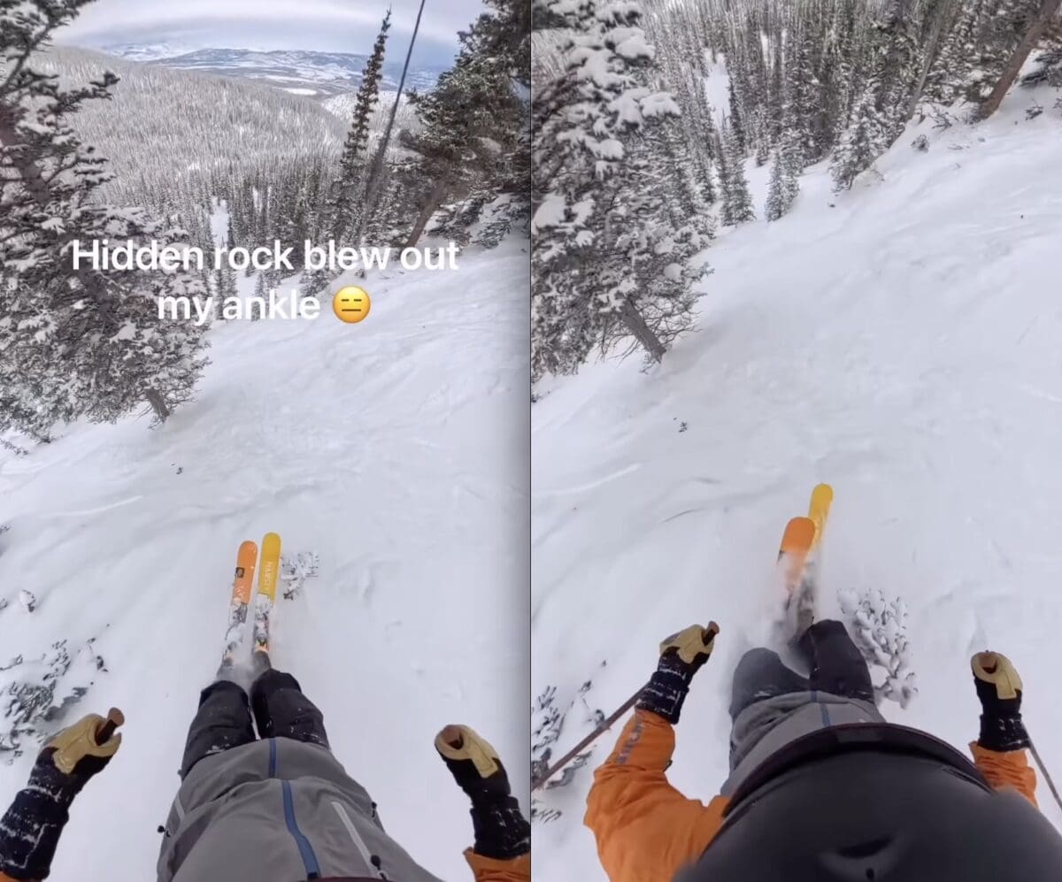 Colorado skier impacts hidden rock.