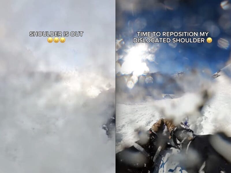 Álvaro Penadés repositions dislocated shoulder.