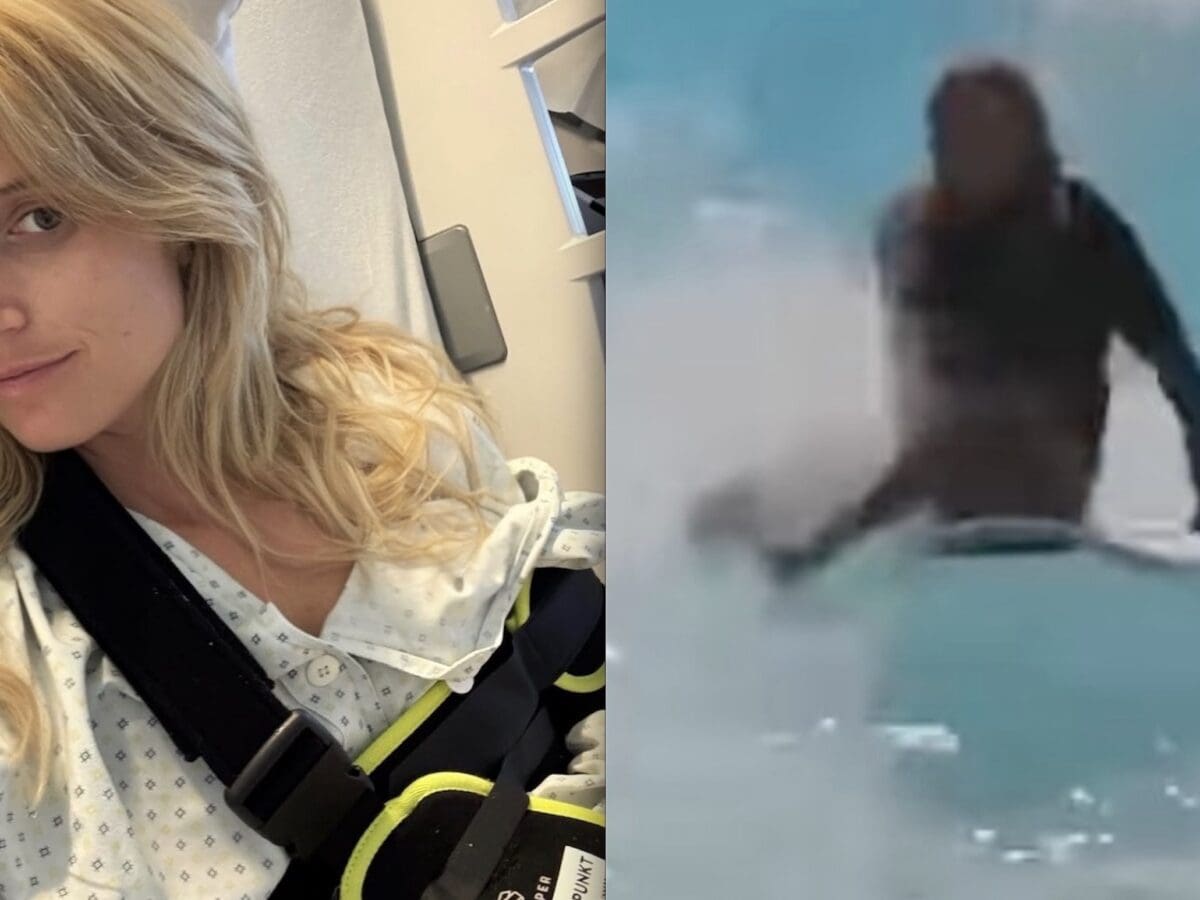 Anna Gasser injured in freak surfing accident in Germany