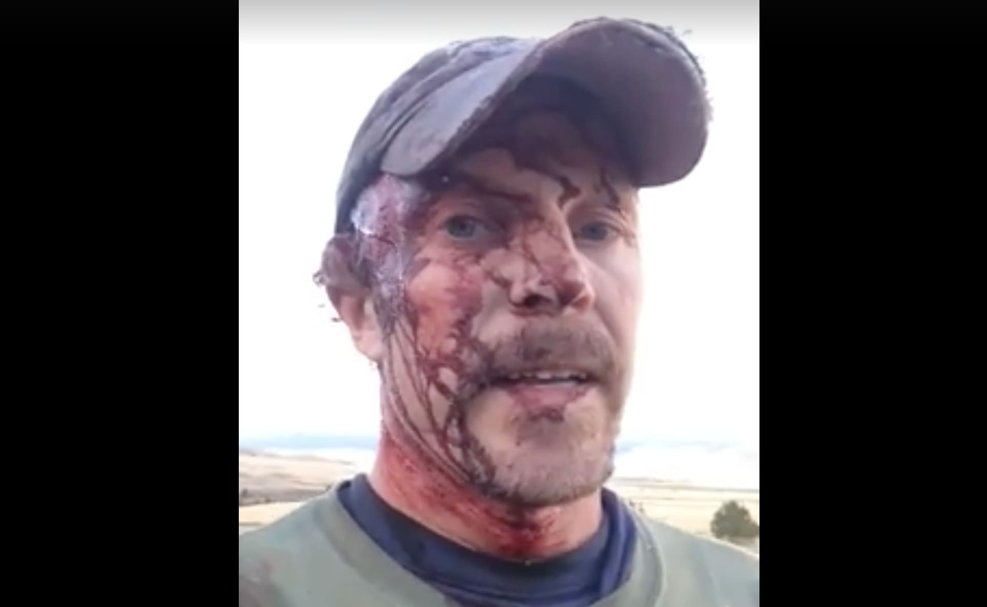 Montana Man Mauled By A Grizzly Bear Twice Posts Video To Facebook Unofficial Networks Montana Man Mauled By A Grizzly Bear Twice Posts Video To Facebook Unofficial Networks