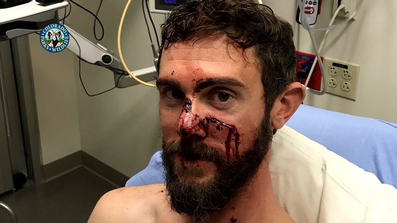 WATCH: Man Who Killed Attacking Mountain Lion With Bare Hands Shares His Brutal Story