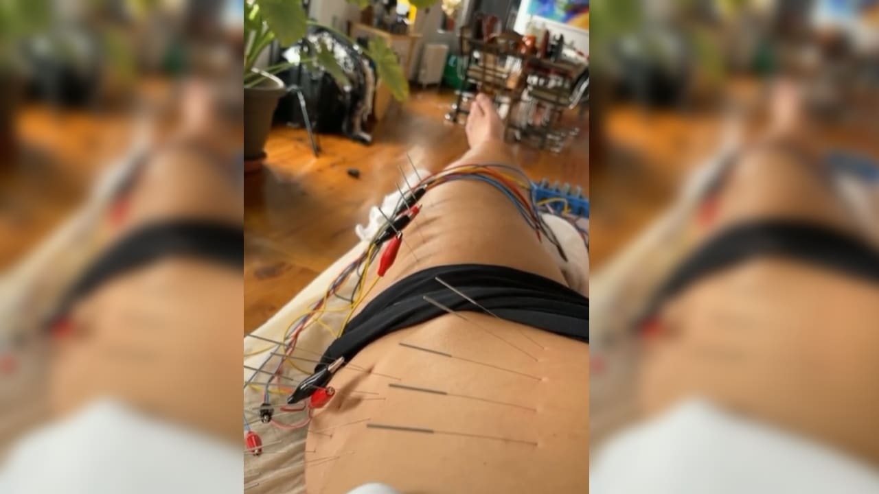 WATCH: Lindsey Vonn Undergoes Twitchy Electroacupuncture Therapy